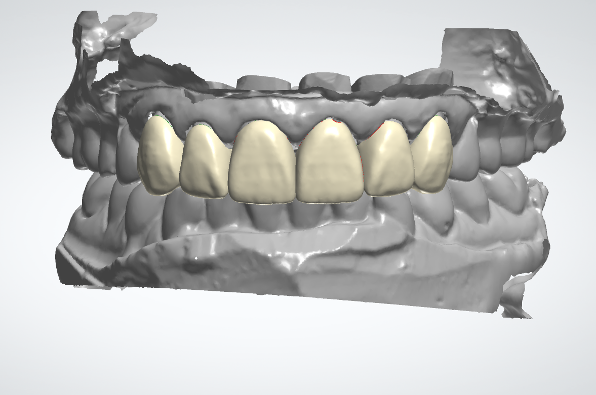 6-0 Units Crown Design
